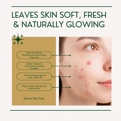 Gloura Whitening & Acne Control Handmade Soap