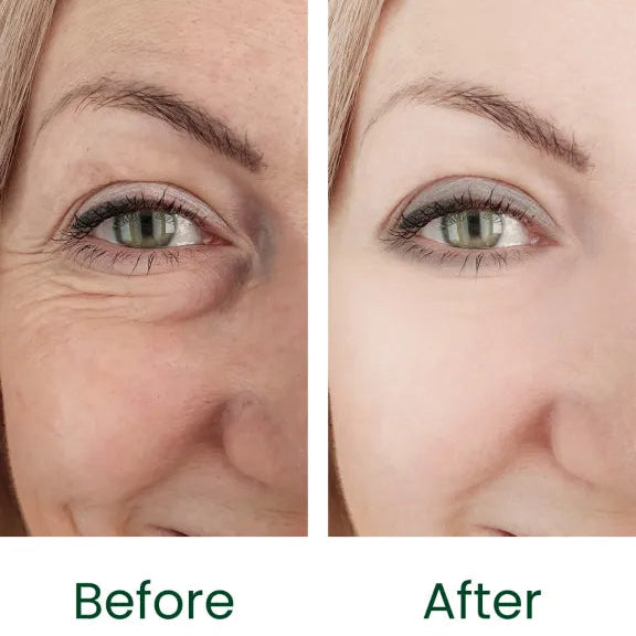 Gloura Whitening & Acne Control Handmade Soap