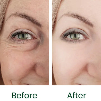 Gloura Whitening & Acne Control Handmade Soap